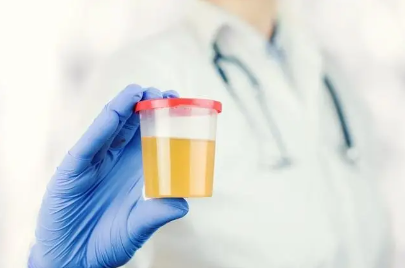 尿酸的化学式是什么