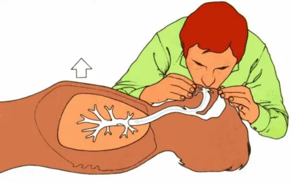 人工呼吸最早的医学家是谁