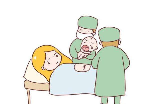 为什么明星都是剖腹产