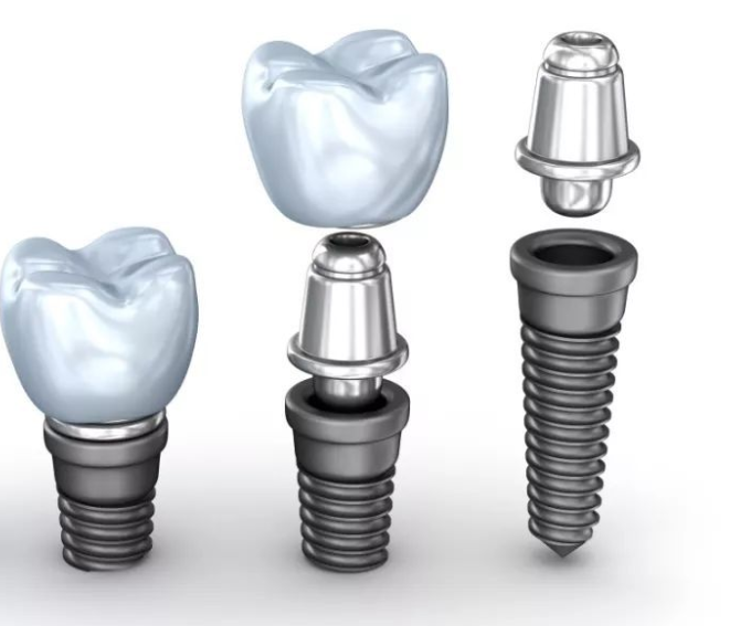 什么人不适合种牙